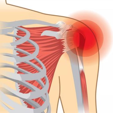 Rotator Cuff Injuries